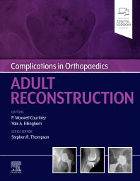 Complications in Orthopaedics: Adult Reconstruction (Hardback) 9780323824378