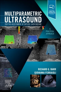 Multiparametric Ultrasound for the Assessment of Diffuse Liver Disease; A Practical Approach (Paperback / softback) 9780323874793