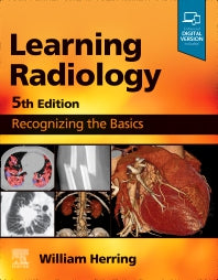 Learning Radiology; Recognizing the Basics (Paperback / softback) 9780323878173