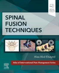 Spinal Fusion Techniques (Hardback) 9780323882231
