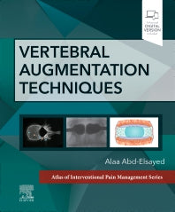 Vertebral Augmentation Techniques (Hardback) 9780323882262