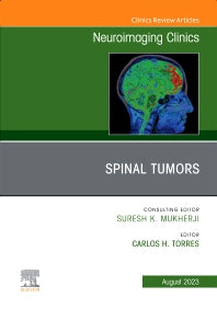 Spinal Tumors, An Issue of Neuroimaging Clinics of North America (Hardback) 9780323938679