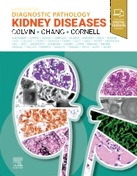 Diagnostic Pathology: Kidney Diseases (Hardback) 9780443107177