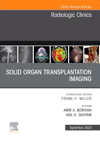 Solid organ transplantation imaging, An Issue of Radiologic Clinics of North America (Hardback) 9780443181771