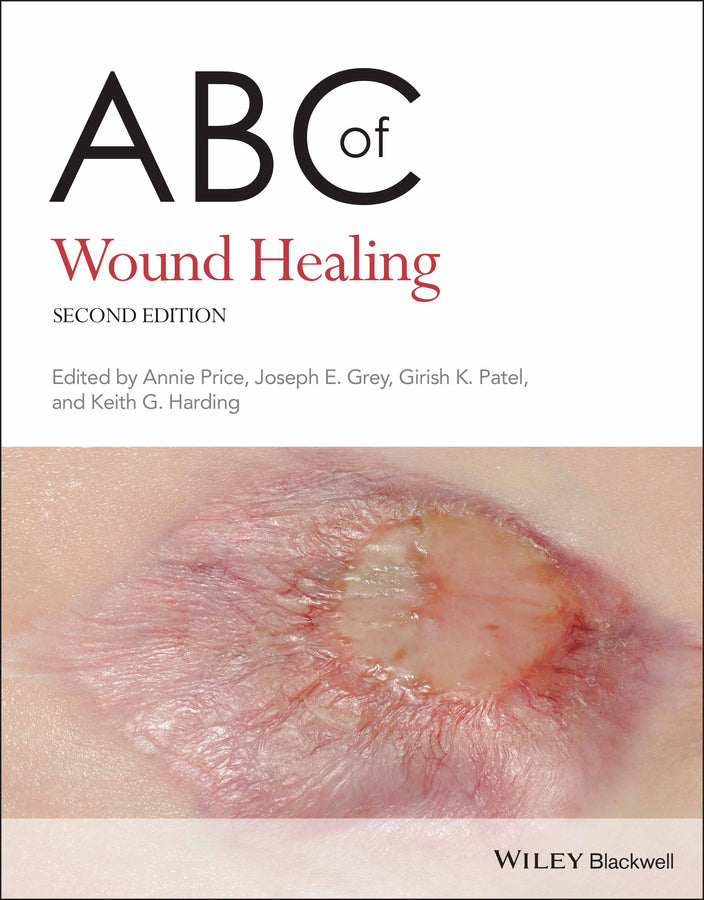 ABC of Wound Healing 2nd Edition (Paperback / softback) 9780470658970