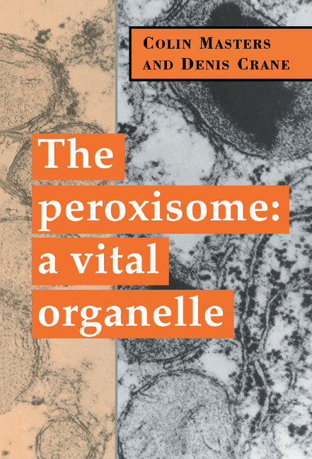 The Peroxisome; A Vital Organelle (Hardback) 9780521482127