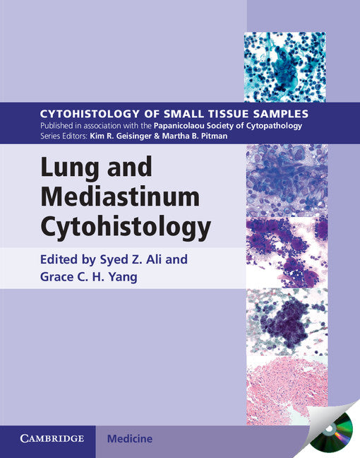 Lung and Mediastinum Cytohistology with CD-ROM () 9780521516587