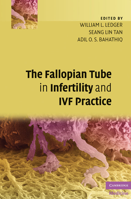 The Fallopian Tube in Infertility and IVF Practice (Hardback) 9780521873789