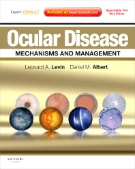 Ocular Disease: Mechanisms and Management; Expert Consult - Online and Print (Hardback) 9780702029837