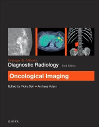 Grainger & Allison’s Diagnostic Radiology: Oncological Imaging (Paperback) 9780702069352