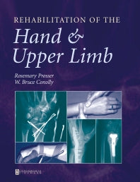 Rehabilitation of the Hand and Upper Limb (Paperback) 9780750622639