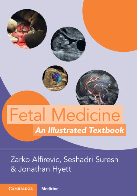 Fetal Medicine; An Illustrated Textbook (Paperback / softback) 9781009015943
