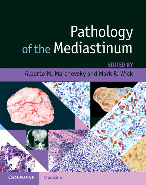 Pathology of the Mediastinum () 9781107031531