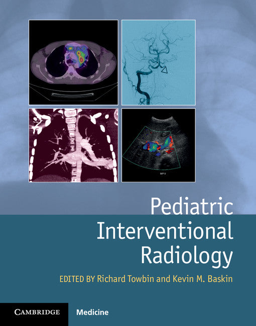 Pediatric Interventional Radiology (Hardback) 9781107042629