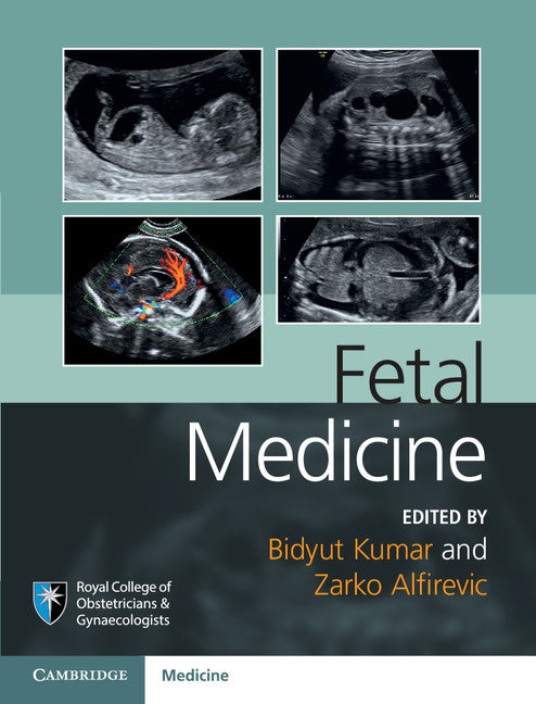 Fetal Medicine (Hardback) 9781107064348