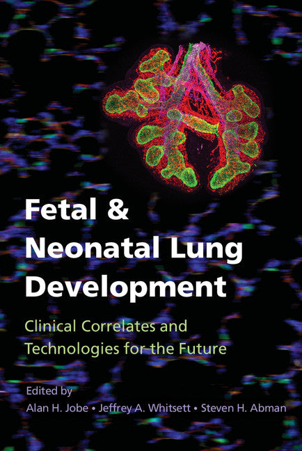 Fetal and Neonatal Lung Development; Clinical Correlates and Technologies for the Future (Hardback) 9781107072091