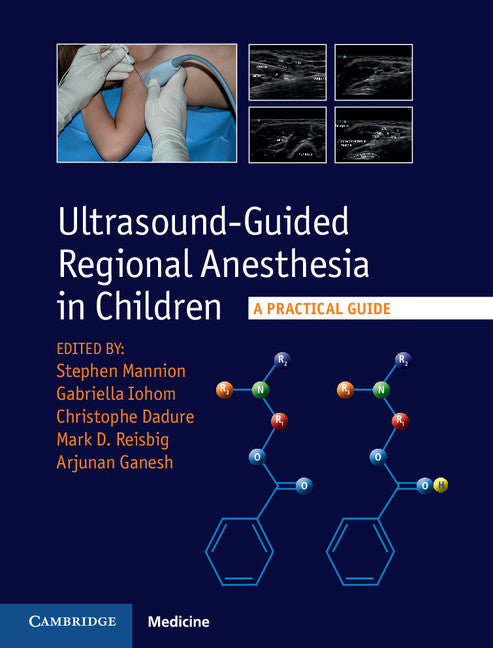 Ultrasound-Guided Regional Anesthesia in Children; A Practical Guide (Hardback) 9781107098770