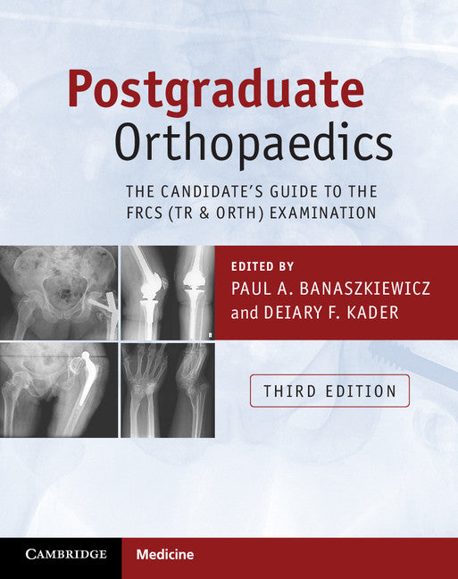 Postgraduate Orthopaedics; The Candidate's Guide to the FRCS (Tr & Orth) Examination (Paperback / softback) 9781107451643