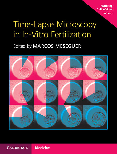 Time-Lapse Microscopy in In-Vitro Fertilization Hardback with Online Resource (Multiple-component retail product) 9781107593268
