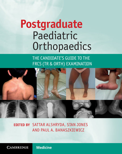 Postgraduate Paediatric Orthopaedics; The Candidate's Guide to the FRCS (Tr and Orth) Examination (Paperback / softback) 9781107644588
