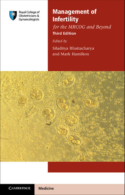 Management of Infertility for the MRCOG and Beyond (Paperback / softback) 9781107678576