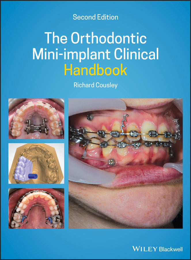 The Orthodontic Mini–implant Clinical Handbook 2nd Edition (Hardback) 9781119509752