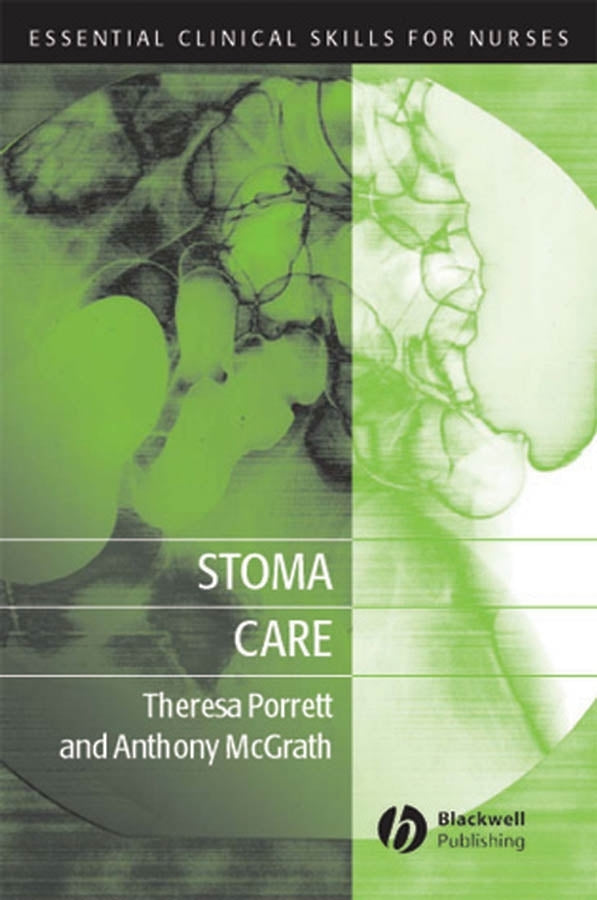 Stoma Care (Paperback / softback) 9781405114073