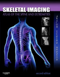 Skeletal Imaging; Atlas of the Spine and Extremities (Hardback) 9781416056232