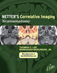 Netter’s Correlative Imaging: Neuroanatomy; with NetterReference.com Access (Hardback) 9781437704150