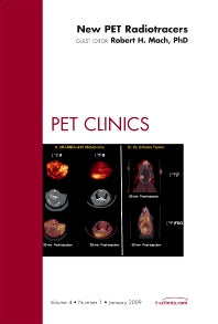 New PET Radiotracers, An Issue of PET Clinics (Hardback) 9781437705249