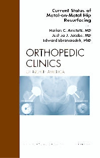 Current Status of Metal-on-Metal Hip Resurfacing, An Issue of Orthopedic Clinics (Hardback) 9781455704798