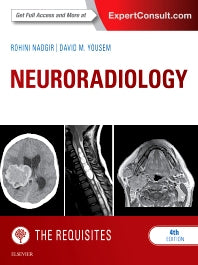 Neuroradiology: The Requisites (Hardback) 9781455775682