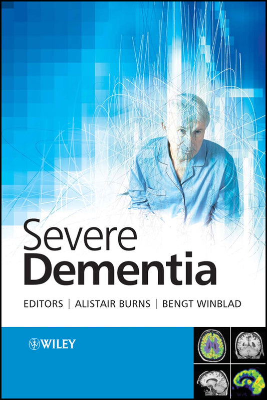 Severe Dementia (Hardback) 9780470010549