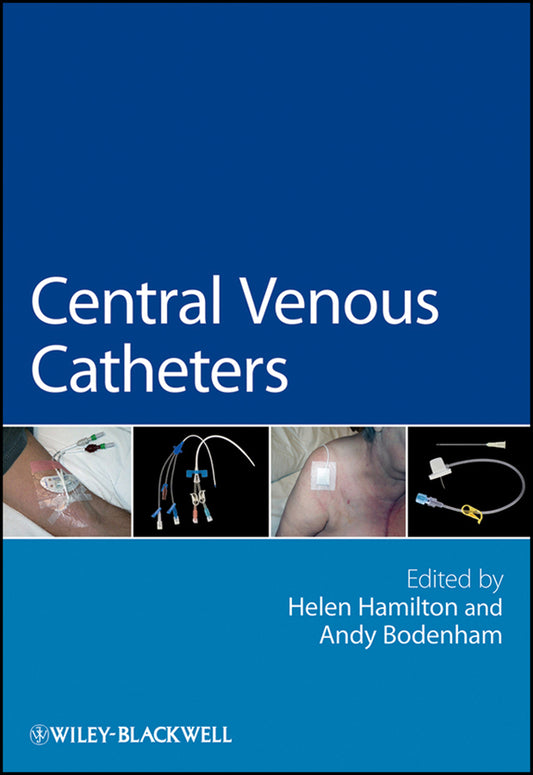 Central Venous Catheters (Paperback / softback) 9780470019948