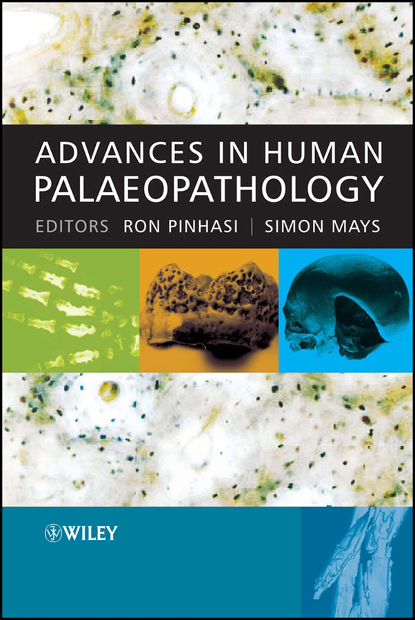 Advances in Human Palaeopathology (Hardback) 9780470036020