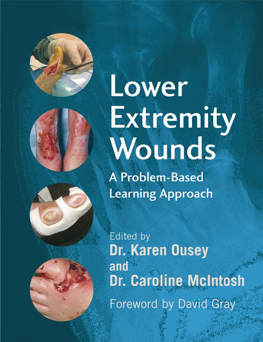 Lower Extremity Wounds; A Problem-Based Approach (Paperback / softback) 9780470059081