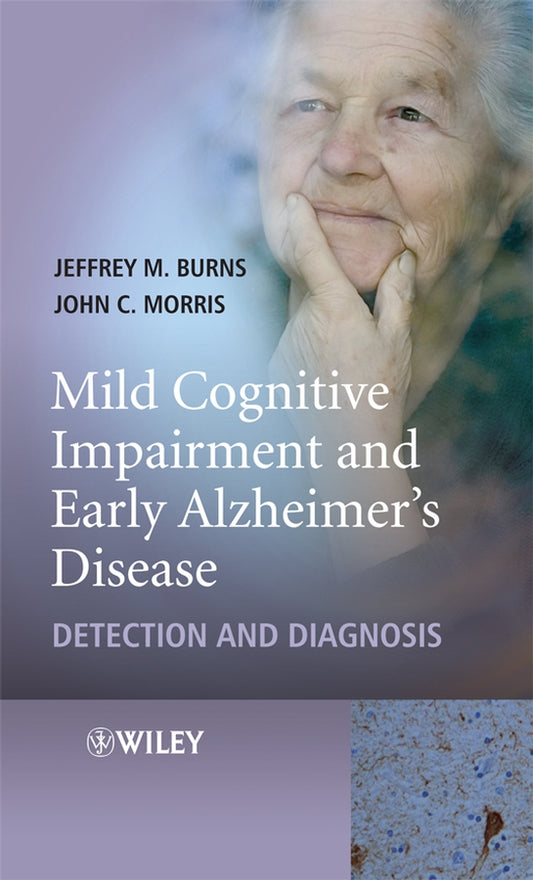 Mild Cognitive Impairment and Early Alzheimer's Disease; Detection and Diagnosis (Hardback) 9780470319369