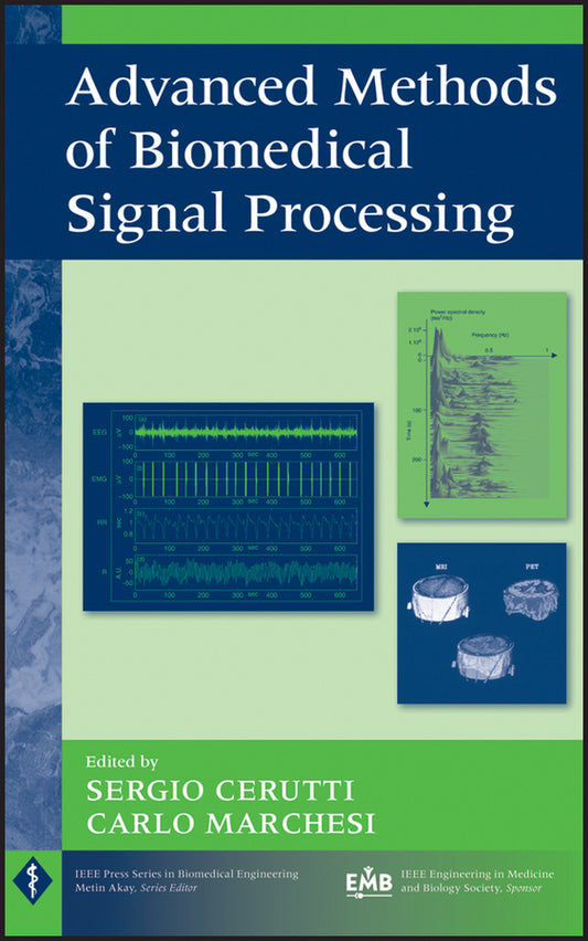 Advanced Methods of Biomedical Signal Processing (Hardback) 9780470422144