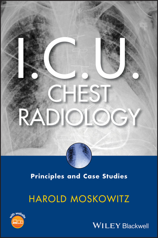 I.C.U. Chest Radiology; Principles and Case Studies (Hardback) 9780470450345