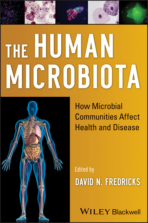 The Human Microbiota; How Microbial Communities Affect Health and Disease (Hardback) 9780470479896