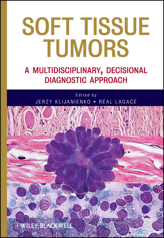 Soft Tissue Tumors; A Multidisciplinary, Decisional Diagnostic Approach (Hardback) 9780470505717