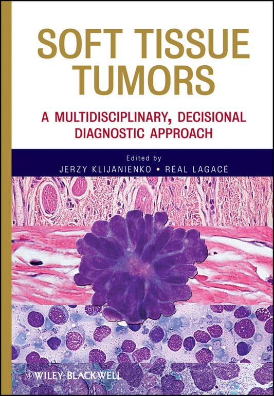 Soft Tissue Tumors; A Multidisciplinary, Decisional Diagnostic Approach (Hardback) 9780470505717