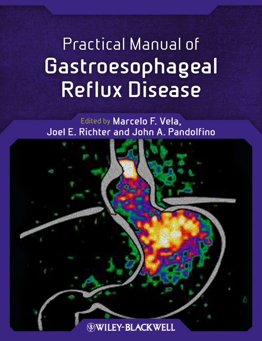 Practical Manual of Gastroesophageal Reflux Disease (Paperback / softback) 9780470656266