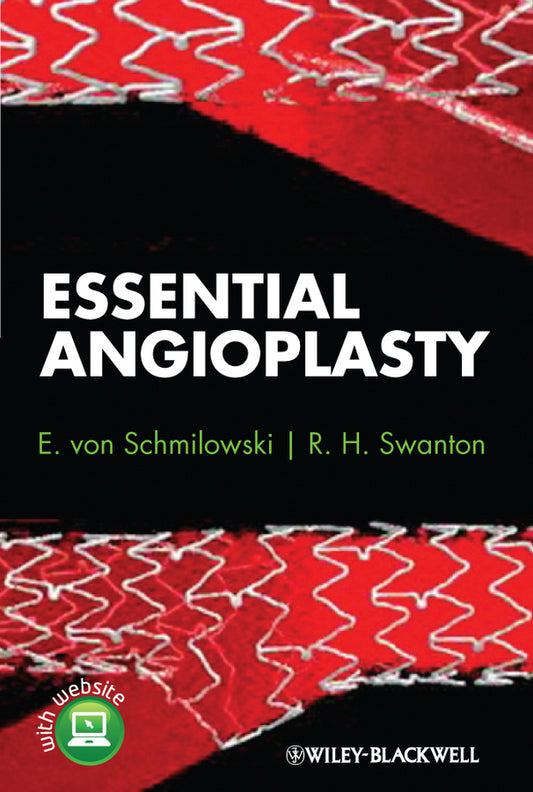 Essential Angioplasty (Hardback) 9780470657263