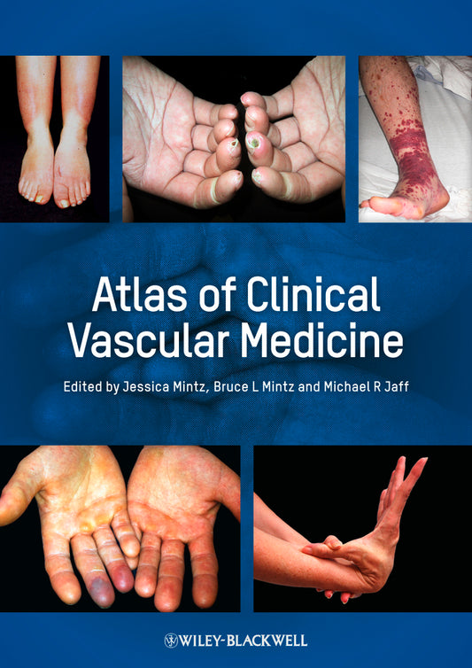 Atlas of Clinical Vascular Medicine (Hardback) 9780470658093