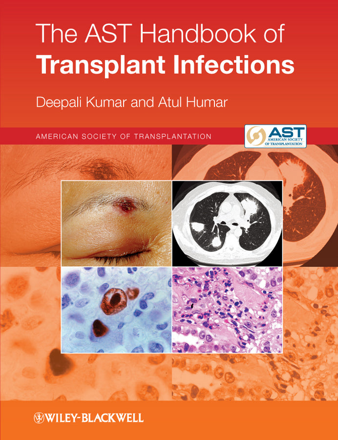 The AST Handbook of Transplant Infections (Paperback / softback) 9780470658277