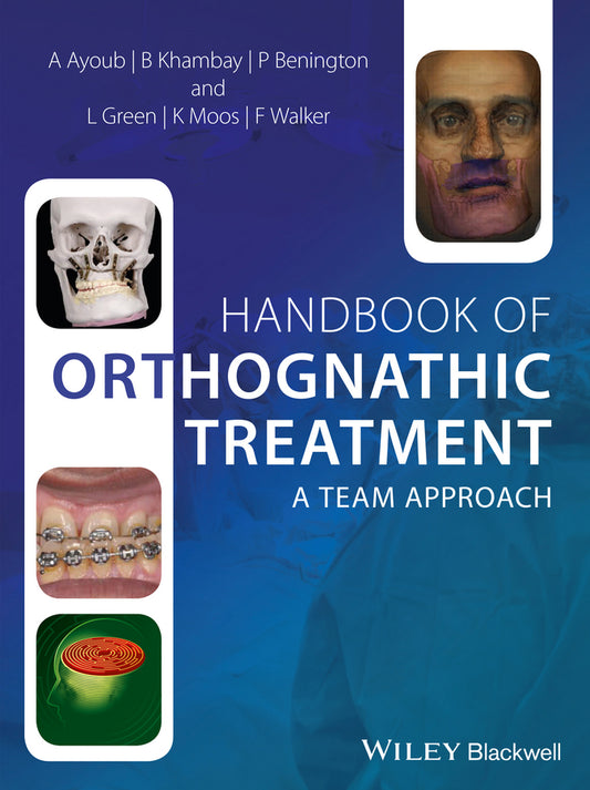 Handbook of Orthognathic Treatment; A Team Approach (Hardback) 9780470659052