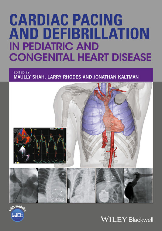 Cardiac Pacing and Defibrillation in Pediatric and Congenital Heart Disease (Hardback) 9780470671092