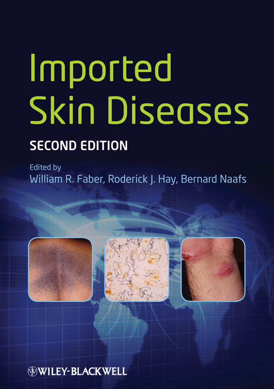 Imported Skin Diseases (Hardback) 9780470672266