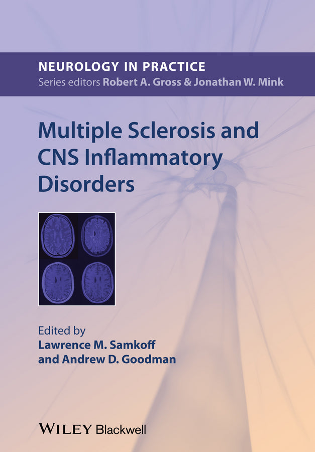 Multiple Sclerosis and CNS Inflammatory Disorders (Paperback / softback) 9780470673881